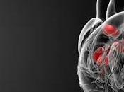 Cardiac Prosthetic Devices Market Size, Share, Growth, Outlook, Opportunity Analysis, Forecast 2020 2027