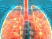 Cystic Fibrosis Market Size, Share, Growth, Outlook, Opportunity Analysis, Forecast 2018 2026