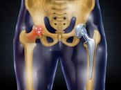 Replacement Market Share, Revenue, Trends, Business Growth, Demand Penetration Forecast 2019 2027