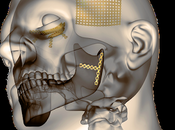 Craniomaxillofacial Implants Market Size, Global Comprehensive Growth, Statistics, Business Strategy, Industry Share, Supply-Demand, Growing Trends Forecast 2019 2027