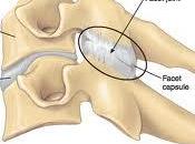 Pain Left Side Neck: Causes Treatment Options