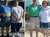Almost Divorced Over Gastric Sleeve Surgery Mexico