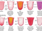 Tongues Indicate Health