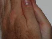 [Atheological] Praise Grace Fasting