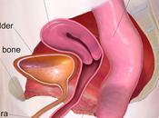 Pelvic Floor Dysfunction