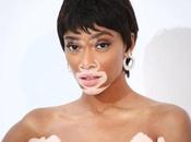 Winnie Harlow Hairstyles