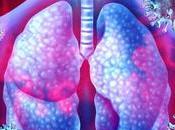 Long COVID-19 Other Chronic Respiratory Conditions After Viral Infections Stem from Overactive Immune Response Lungs