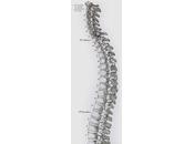 Friday Q&amp;A: Kyphosis (Dowager's Hump)