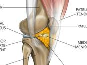 Infrapatellar Syndrome