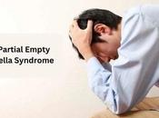 Partial Empty Sella Syndrome Treatment Ayurveda