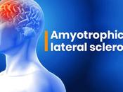 Amyotrophic Lateral Sclerosis Treatment Herbal Remedies