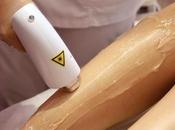 Decide Laser Hair Removal Right