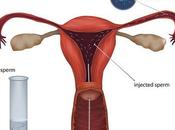 Artificial Insemination Involves Introducing Semen Into Female's Vagina Cervix Method Other Than Sexual Contact