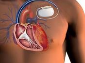 Smoking Obesity Boosts Implantable Cardioverter Defibrillator Market Growth