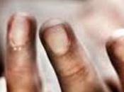 Nine Year Dies Strangulation Saree Cradle