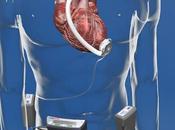 Cardiac Assist Devices Market Comprehensive Overview