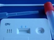 Global Shigella Test Market Estimated Witness High Growth Owing Increasing Awareness About Foodborne Illnesses