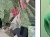 Another Mistake Flipkart, Buyer Stone Instead Thousand Rupees Smartphone