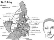 Treatment Bell’s Palsy Augusta