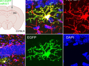 Guardian Brain Microglia.