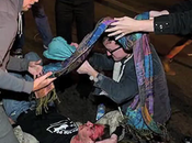 Occupy Oakland Protestor Scott Olsen’s Skull Fractured During Police Crack-down, Responds