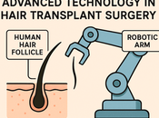 Technology Changing Hair Transplant Surgery