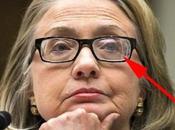 Ophalmologist Says Hillary’s Thick Glasses Were Double Vision from “severe Head Trauma”