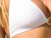 Auto Augmentation Breast Lift Surgery Guide