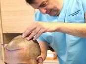 Guide Choosing Right Hair Restoration Clinic