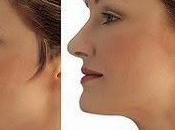 Tips Lose Chin Discover Reduce Easily