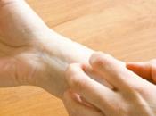 Most Effective Home Remedies Eczema Scars